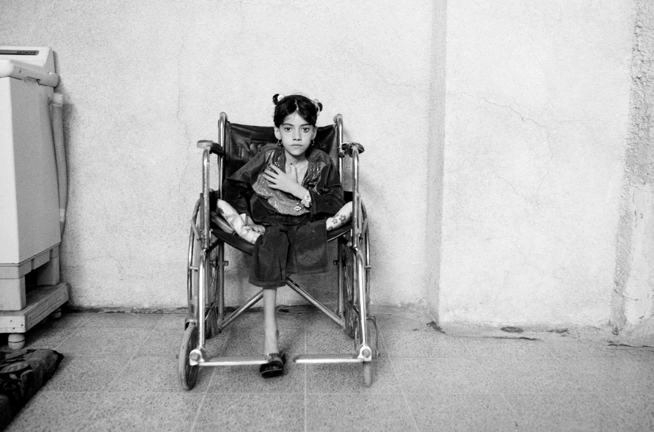 Young girl sitting in wheelchair